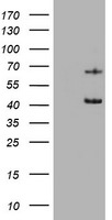 KRT5 Antibody in Western Blot (WB)