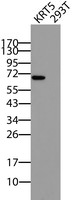 KRT5 Antibody in Western Blot (WB)