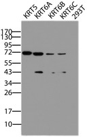 KRT5 Antibody in Western Blot (WB)
