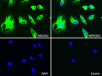 KRT7 Antibody in Immunocytochemistry (ICC/IF)
