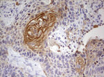 KRT7 Antibody in Immunohistochemistry (Paraffin) (IHC (P))