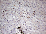 KRT7 Antibody in Immunohistochemistry (Paraffin) (IHC (P))