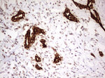 KRT7 Antibody in Immunohistochemistry (Paraffin) (IHC (P))