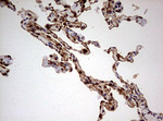 KRT7 Antibody in Immunohistochemistry (Paraffin) (IHC (P))