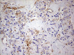 KRT7 Antibody in Immunohistochemistry (Paraffin) (IHC (P))