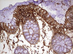 KRT7 Antibody in Immunohistochemistry (Paraffin) (IHC (P))