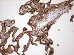 KRT7 Antibody in Immunohistochemistry (Paraffin) (IHC (P))