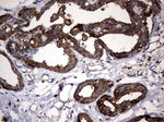 KRT7 Antibody in Immunohistochemistry (Paraffin) (IHC (P))