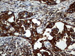 KRT7 Antibody in Immunohistochemistry (Paraffin) (IHC (P))
