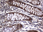 KRT7 Antibody in Immunohistochemistry (Paraffin) (IHC (P))