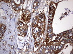 KRT7 Antibody in Immunohistochemistry (Paraffin) (IHC (P))