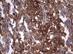 KRT7 Antibody in Immunohistochemistry (Paraffin) (IHC (P))