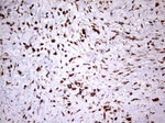 KRT7 Antibody in Immunohistochemistry (Paraffin) (IHC (P))