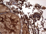 KRT7 Antibody in Immunohistochemistry (Paraffin) (IHC (P))