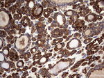 KRT7 Antibody in Immunohistochemistry (Paraffin) (IHC (P))