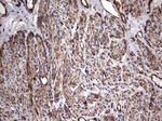 KRT7 Antibody in Immunohistochemistry (Paraffin) (IHC (P))