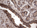 KRT7 Antibody in Immunohistochemistry (Paraffin) (IHC (P))