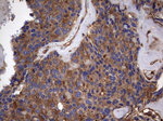 KRT7 Antibody in Immunohistochemistry (Paraffin) (IHC (P))