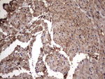 KRT7 Antibody in Immunohistochemistry (Paraffin) (IHC (P))