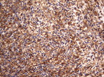KRT7 Antibody in Immunohistochemistry (Paraffin) (IHC (P))