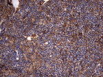 KRT7 Antibody in Immunohistochemistry (Paraffin) (IHC (P))
