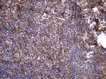 KRT7 Antibody in Immunohistochemistry (Paraffin) (IHC (P))