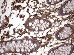 KRT7 Antibody in Immunohistochemistry (Paraffin) (IHC (P))