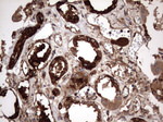 KRT7 Antibody in Immunohistochemistry (Paraffin) (IHC (P))