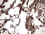 KRT7 Antibody in Immunohistochemistry (Paraffin) (IHC (P))