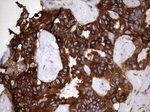 KRT7 Antibody in Immunohistochemistry (Paraffin) (IHC (P))