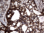 KRT7 Antibody in Immunohistochemistry (Paraffin) (IHC (P))