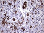 KRT7 Antibody in Immunohistochemistry (Paraffin) (IHC (P))