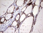 KRT7 Antibody in Immunohistochemistry (Paraffin) (IHC (P))