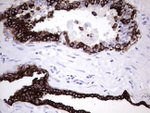 KRT7 Antibody in Immunohistochemistry (Paraffin) (IHC (P))