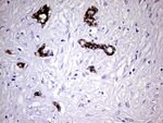 KRT7 Antibody in Immunohistochemistry (Paraffin) (IHC (P))
