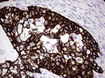 KRT7 Antibody in Immunohistochemistry (Paraffin) (IHC (P))