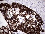 KRT7 Antibody in Immunohistochemistry (Paraffin) (IHC (P))