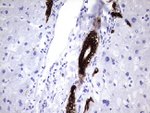 KRT7 Antibody in Immunohistochemistry (Paraffin) (IHC (P))
