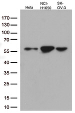 KRT7 Antibody in Western Blot (WB)