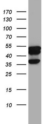 KRT7 Antibody in Western Blot (WB)