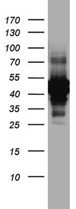 KRT7 Antibody in Western Blot (WB)