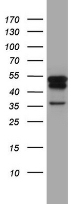 KRT7 Antibody in Western Blot (WB)