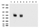 KRT7 Antibody in Western Blot (WB)