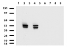 KRT7 Antibody in Western Blot (WB)
