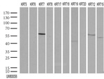 KRT7 Antibody in Western Blot (WB)