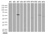 KRT7 Antibody in Western Blot (WB)