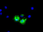 KRT8 Antibody in Immunocytochemistry (ICC/IF)