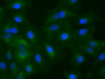 KRT8 Antibody in Immunocytochemistry (ICC/IF)