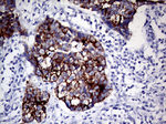 KRT8 Antibody in Immunohistochemistry (Paraffin) (IHC (P))
