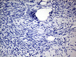 KRT8 Antibody in Immunohistochemistry (Paraffin) (IHC (P))